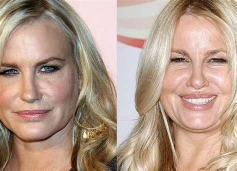 jennifer coolidge before plastic surgery|Jennifer Coolidge Was Slammed With Plastic Surgery。